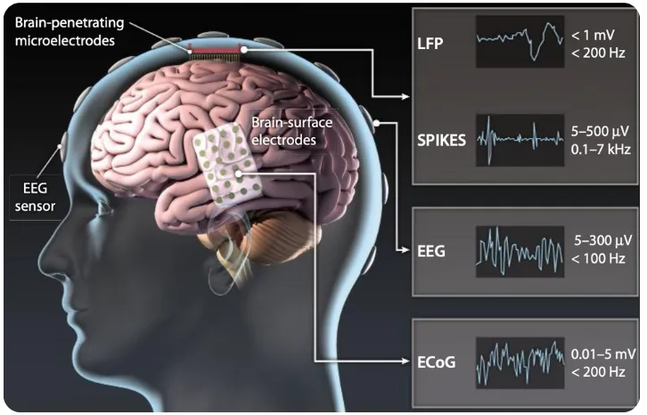 Modalities for measuring brain electrical activity